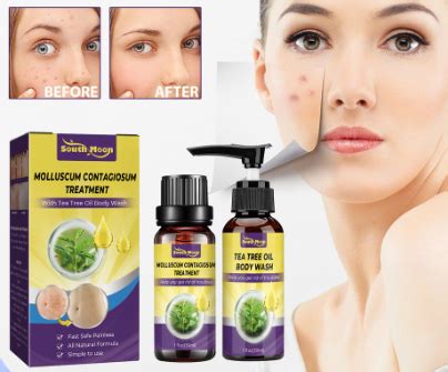 salicylic acid gamot sa kulugo|Gamot Sa Kulugo: Paggamot Na Maaaring Gawin Sa Bahay.